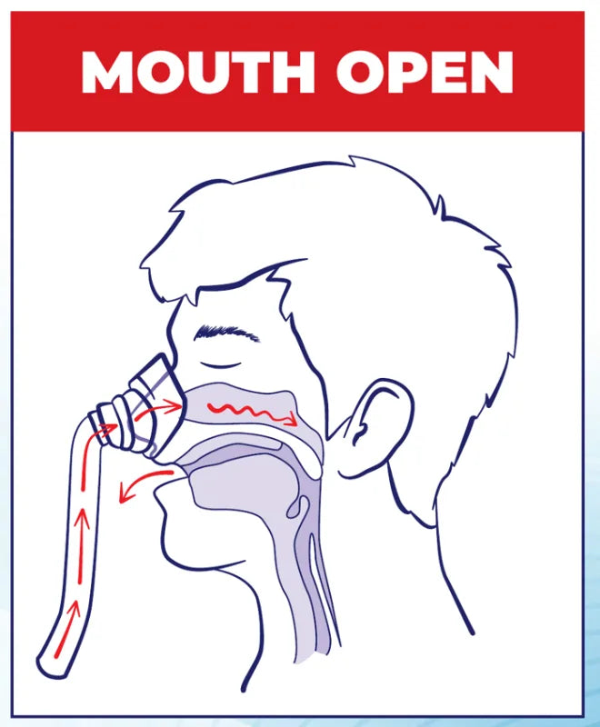 Mouth open.
