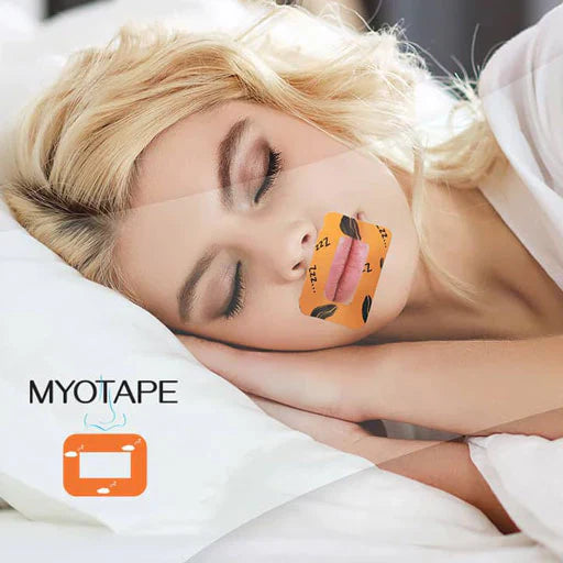 Woman sleeping with myotape mouth tape. Breathing Through the Nose During Sleep Improves Adherence to CPAP