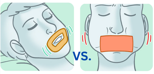 MyoTape vs. Other Mouth Tapes: 7 Solid Reasons to Choose MyoTape